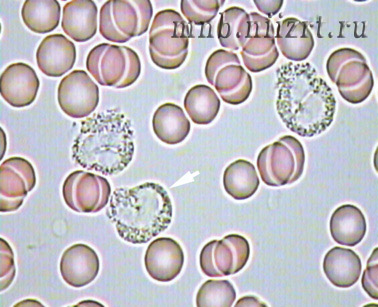 лейкоциты с зернистостью